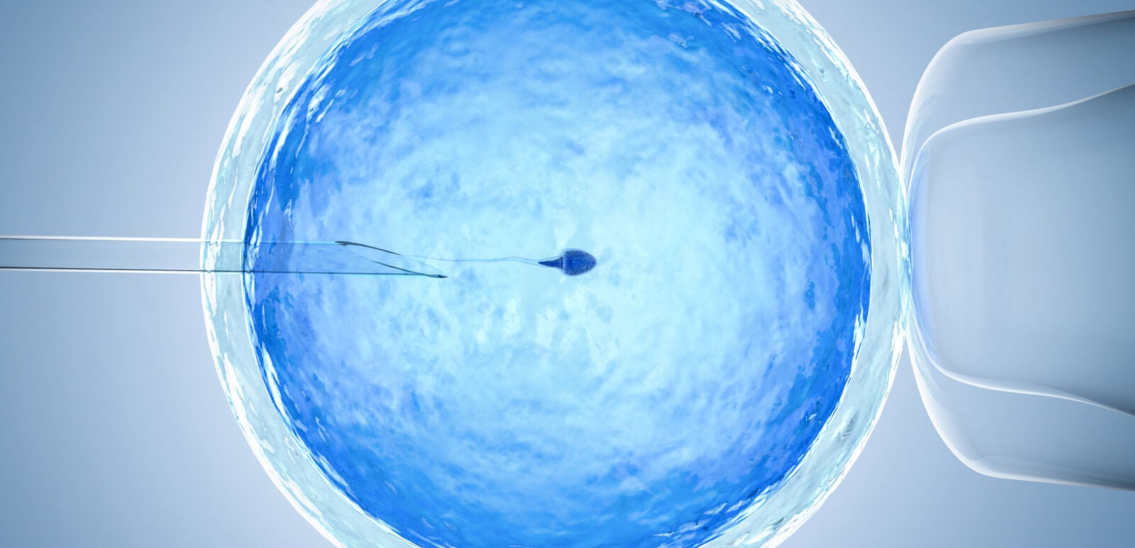 Illustration of in vitro fertilization showing a sperm being injected into an egg using a microscopic needle.